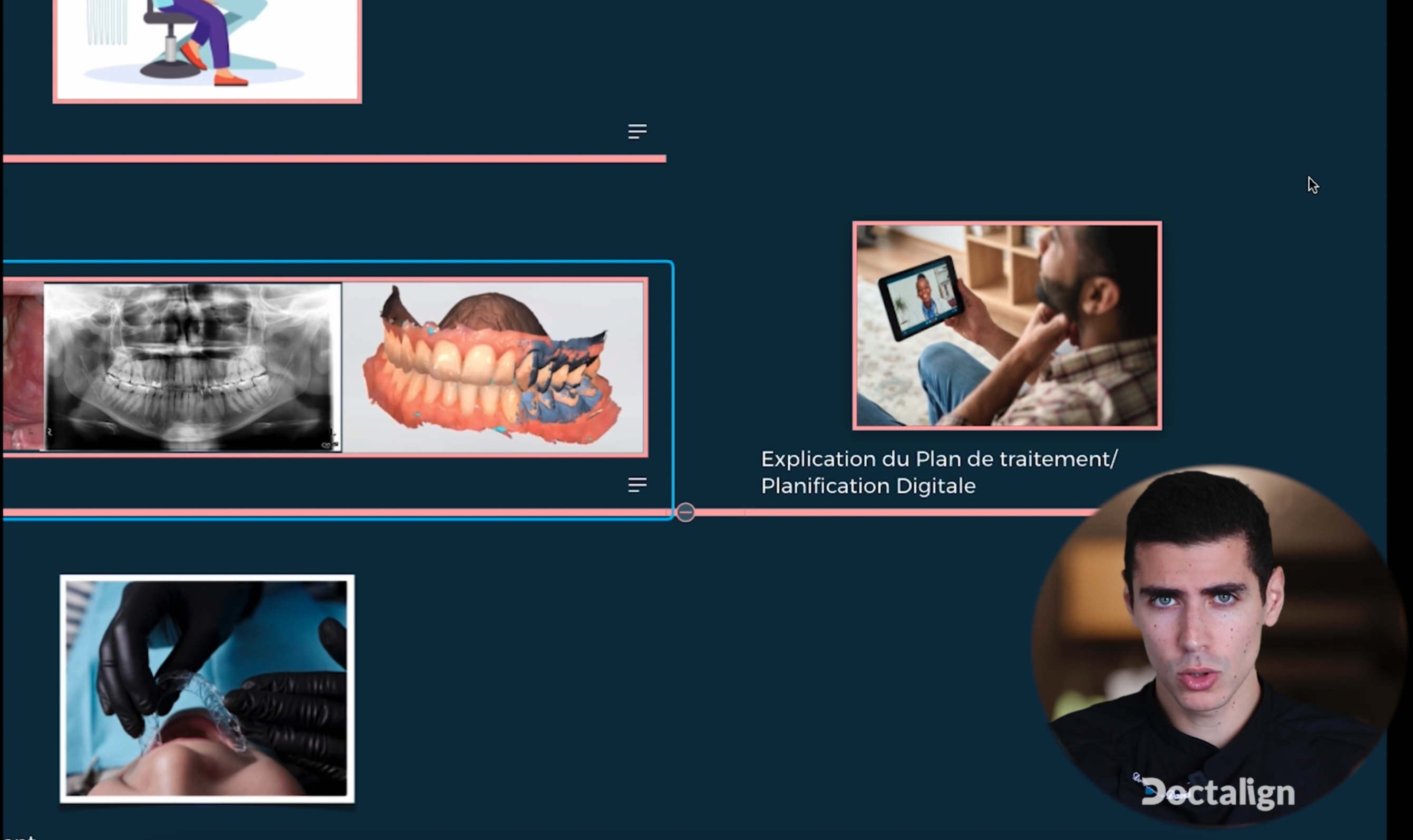 Les Étapes cliniques de traitement en orthodontie