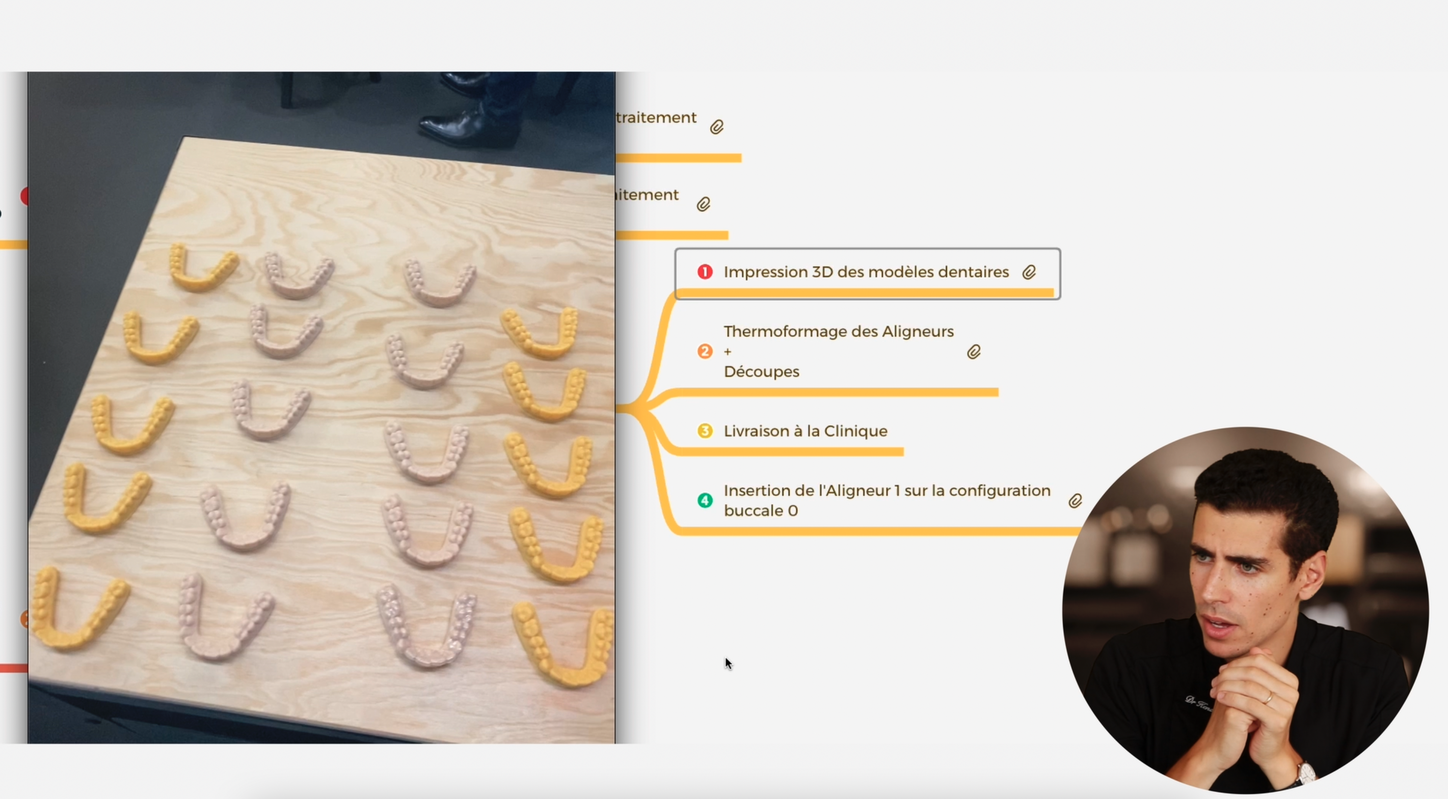 Etapes de fabrication des aligneurs 