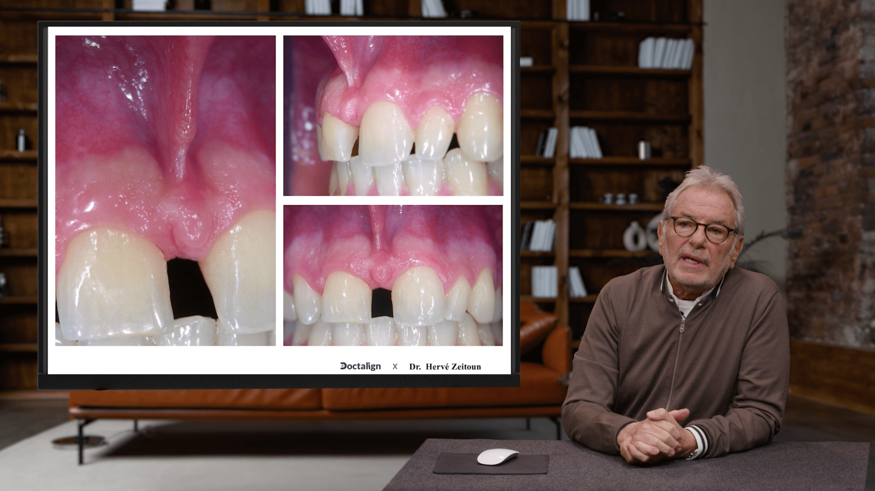 Indications et Diagnostic