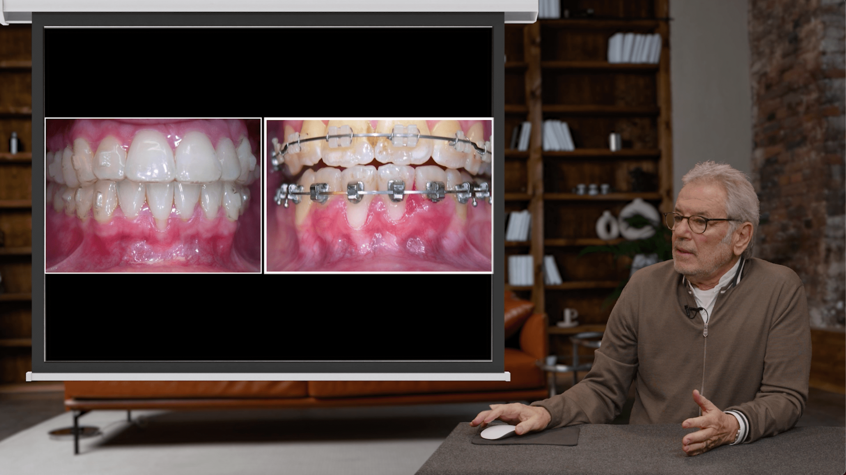 Les relations paro-ortho