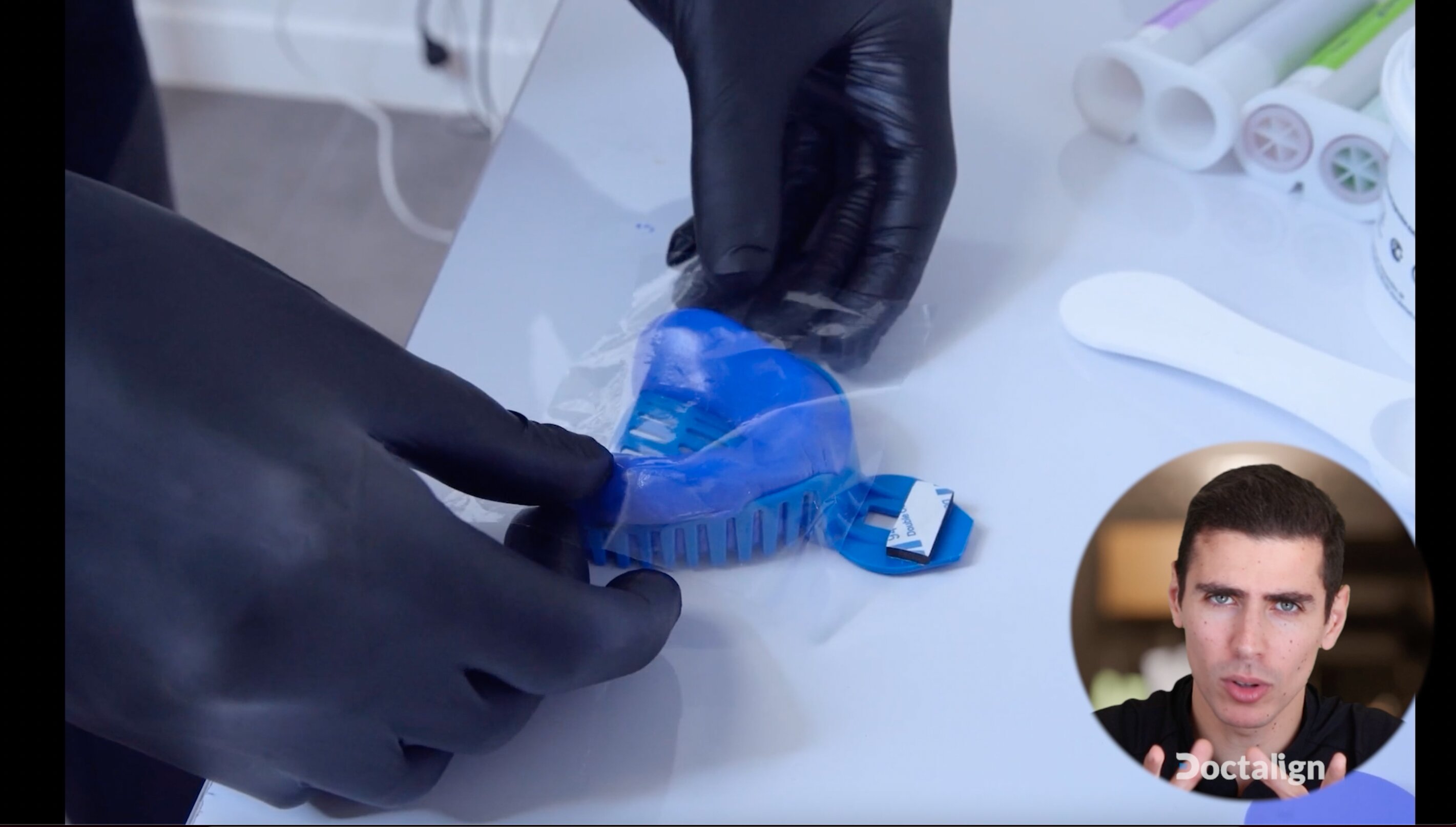 La Prise d'empreinte en aligneurs orthodontie