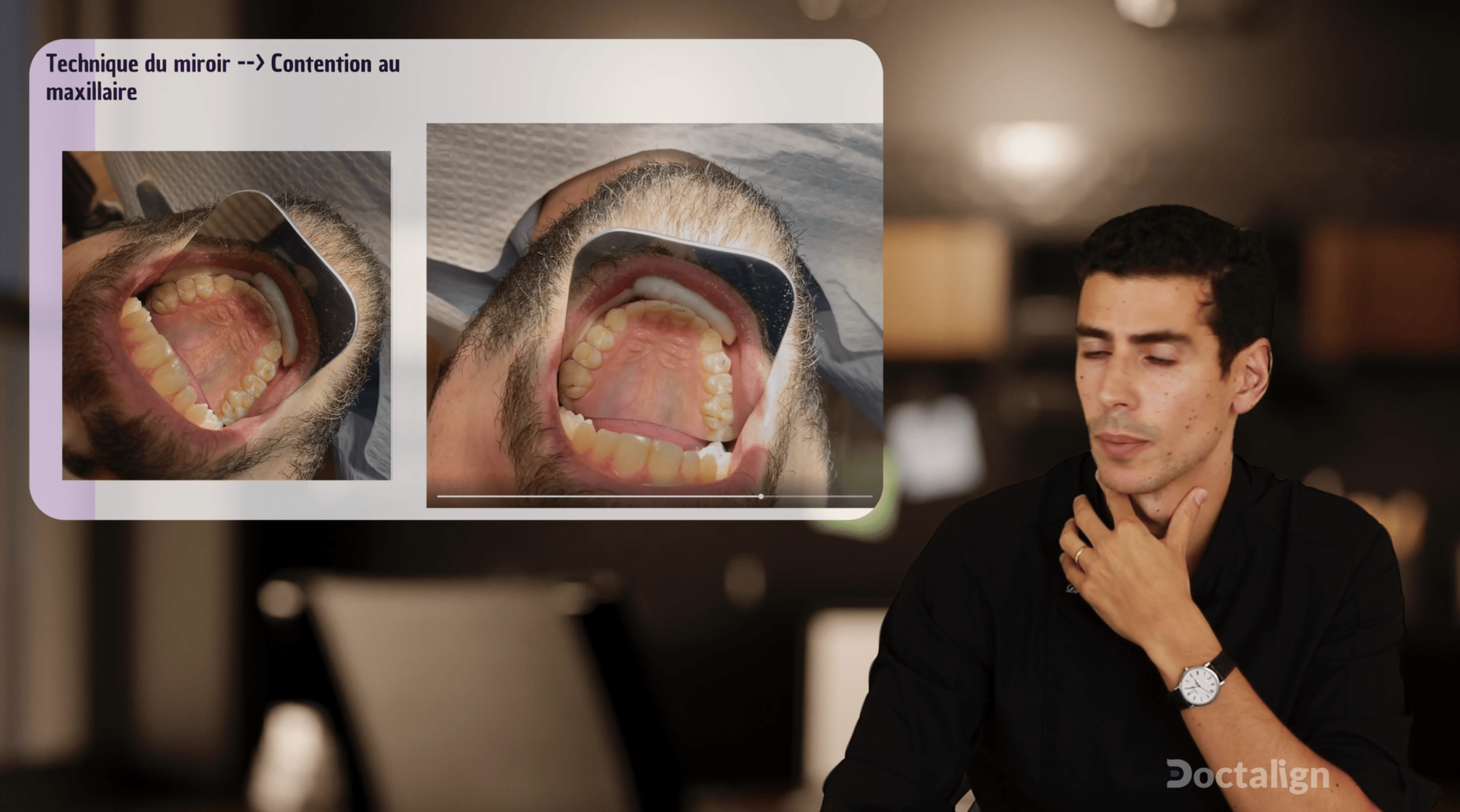 Collage de la contention